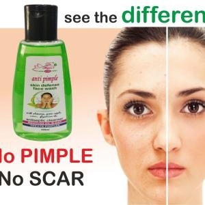 ANTI PIMPLE | Acne & Oil Control | Suitable to All Skin Types | FACE WASH with NEEM & ALOVERA 1+1 EXTRA