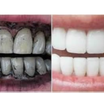 AMK Herbal GUAVA Tooth Powder with Rice Husk and Salt, 100% Natural, Chemical-Free, 200g