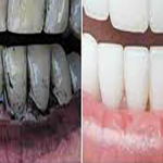 AMK2 Herbal Umikari Rice Husk Tooth Powder with Salt, Natural, Chemical Free, Color Free, 200g