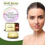 Rotex Zee Acnedim Anti Acne Soap For Acne Prone & Oily Skin With Anti-microbial Action I Astringent Cleansing Soap 75 gm