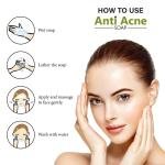 Rotex Zee Acnedim Anti Acne Soap For Acne Prone & Oily Skin With Anti-microbial Action I Astringent Cleansing Soap 75 gm