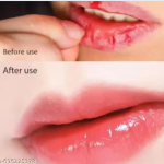 Moisturizing Lip Balm for Daily Use